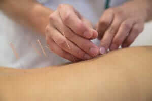 Patient Participating in Post-Detox Acupuncture Treatment for Drug Addiction